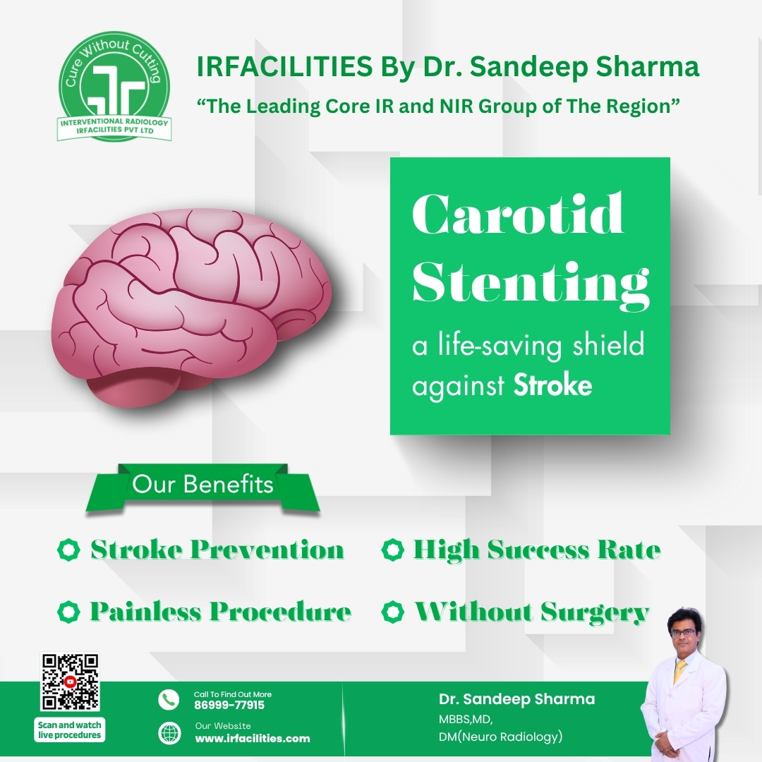 Advanced Carotid Artery Stenting Procedure Explained